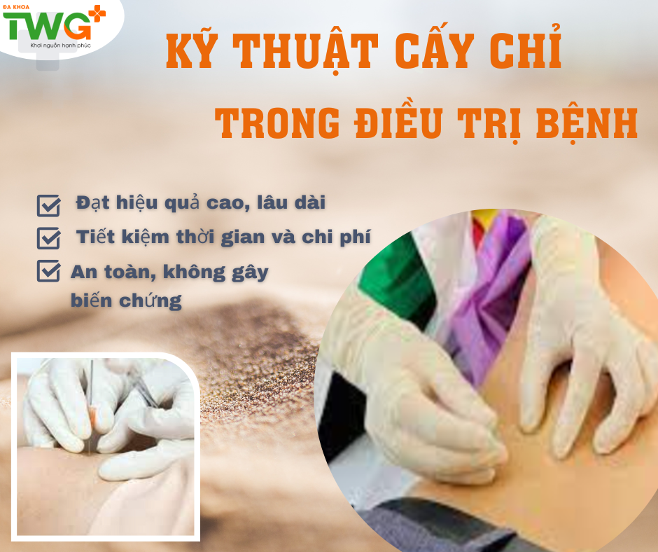 KỸ THUẬT CẤY CHỈ TRONG ĐIỀU TRỊ BỆNH