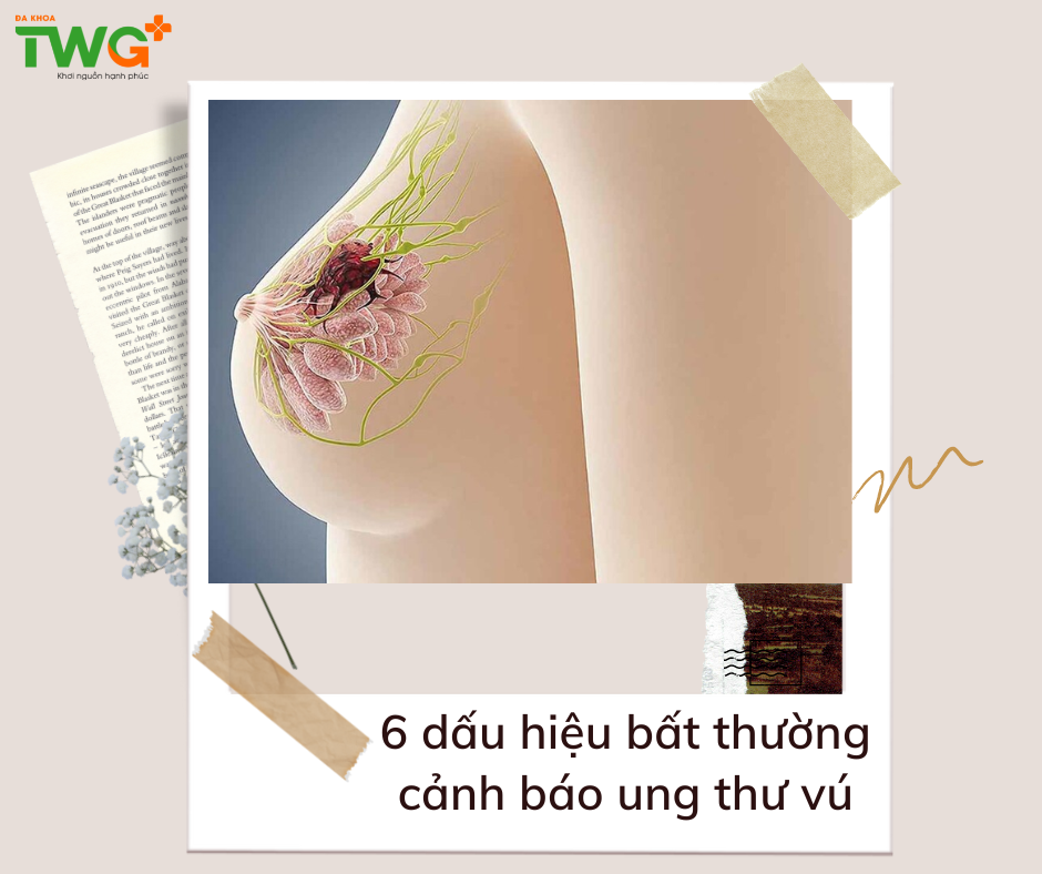 ​6 dấu hiệu bất thường cảnh báo ung thư vú