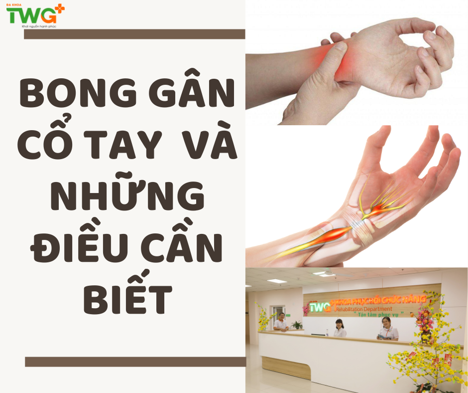 Bong gân cổ tay và những điều cần biết